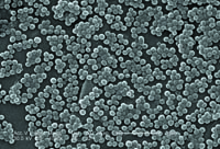 Гидротермальный синтез нанокристаллического гидроксида алюминия 
